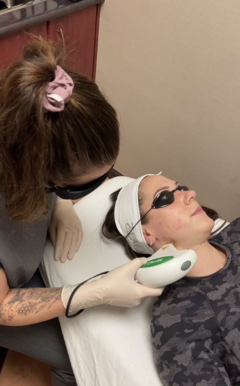 Intense Pulsed Light (IPL) Treatment with MD Cosmetic